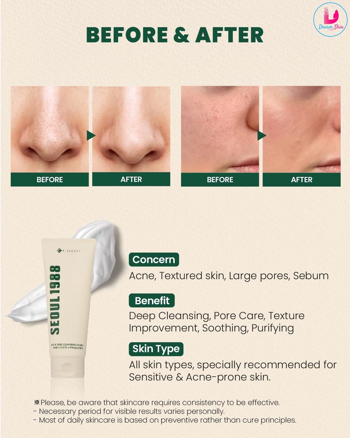 KSECRET SEOUL 1988 Cleansing Foam Pine Cica 1% + Probiotics 150ml